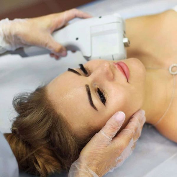 HIFU – Donji dio lica