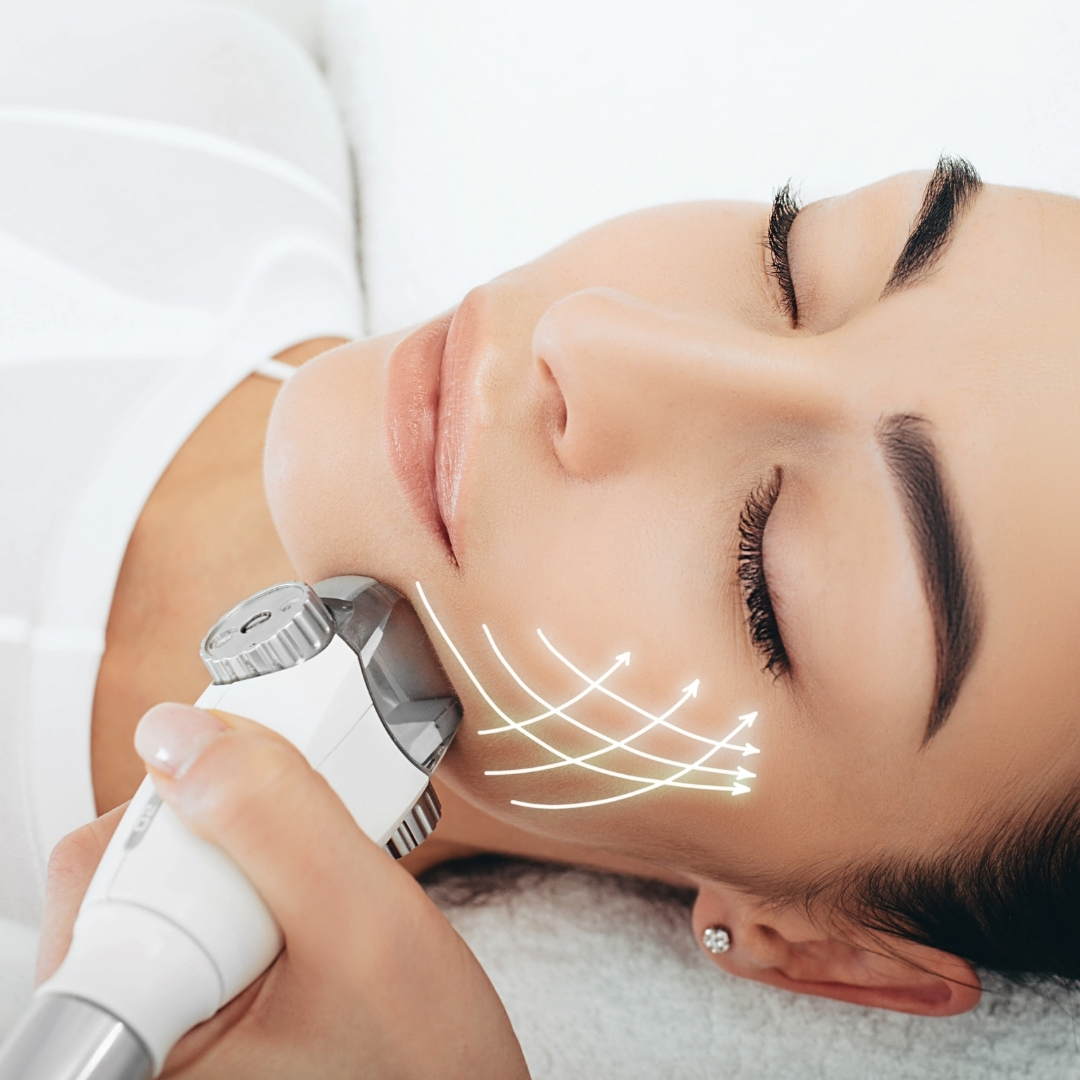 LPG Lift Académie Hydra