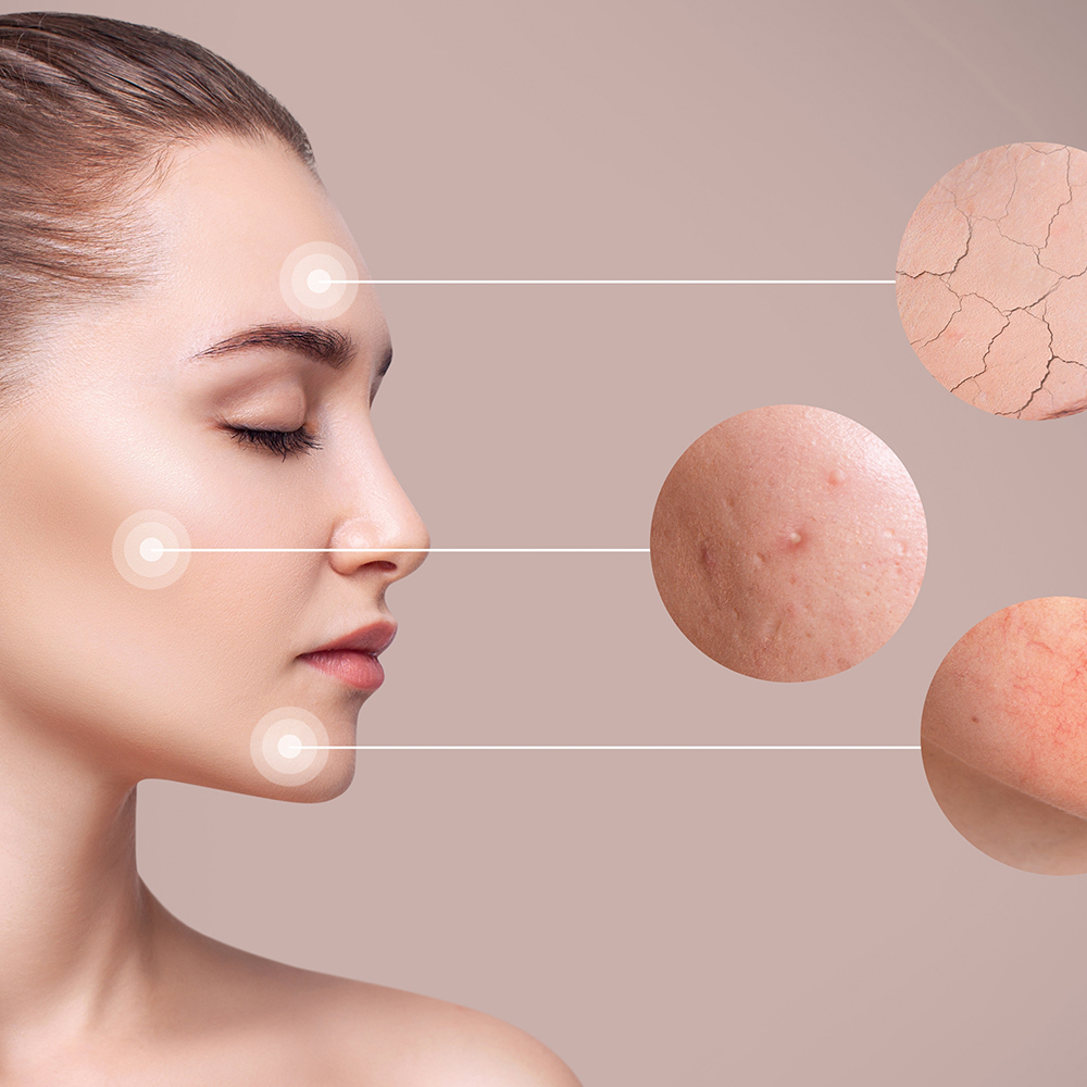 TROIPEEL 365 SKIN RESET™